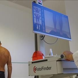 Hospiten Roca incorporates Fotofinder for exhaustive monitoring of the skin